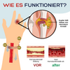 KupferArmreif ™ - Befreien Sie sich von Schwellungen und Gelenkschmerzen!